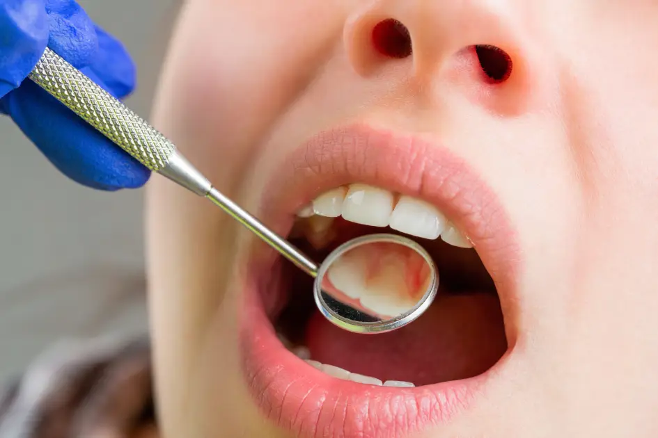 Same-Day Emergency Dental Care in Spring, TX: What to Expect